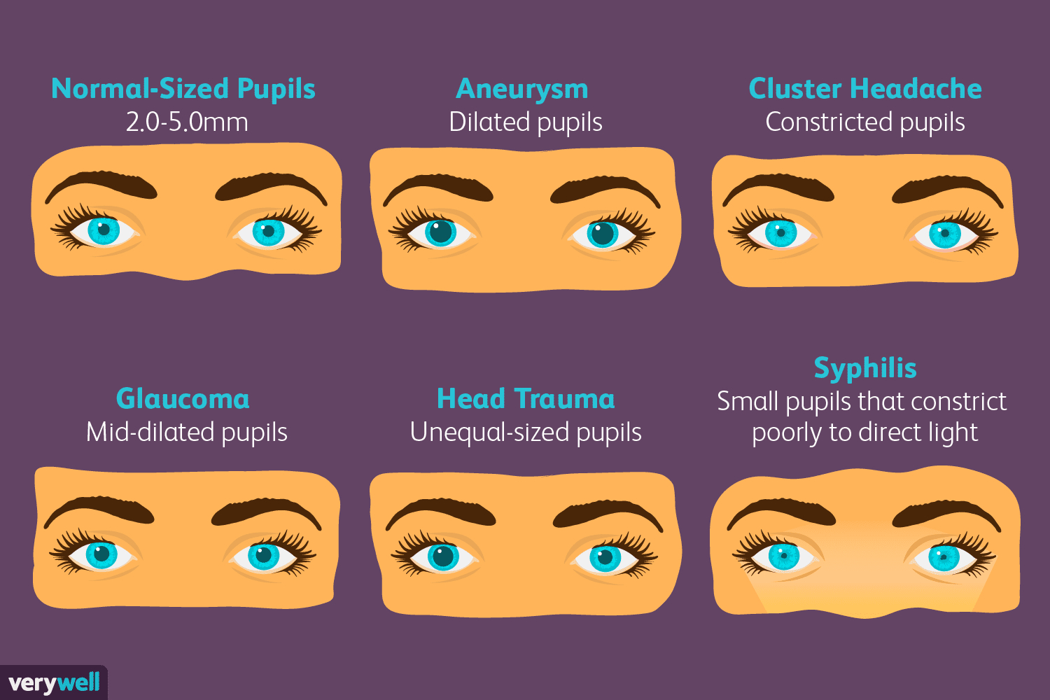 Abnormal Pupil Size: Causes And Symptoms intended for Pupil Size Chart Printable