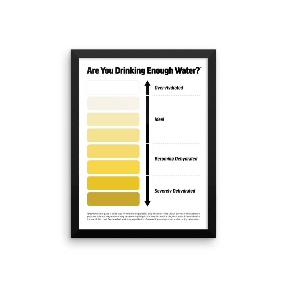 Framed Urine Color Chart, Pee Color Chart, Water Intake Chart, Pee inside Urine Color Chart Printable