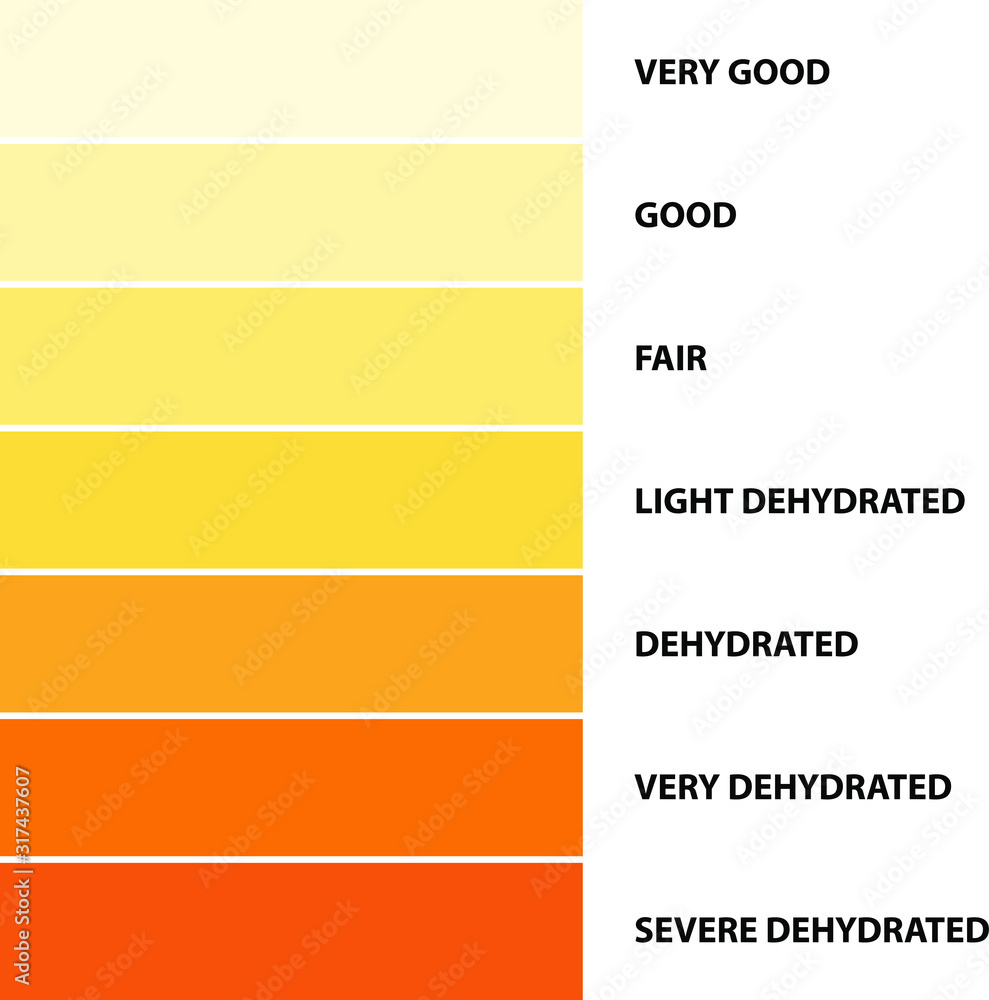Urine Color, Dehydration Urine Color Chart, Vector Illustration inside Urine Color Chart Printable