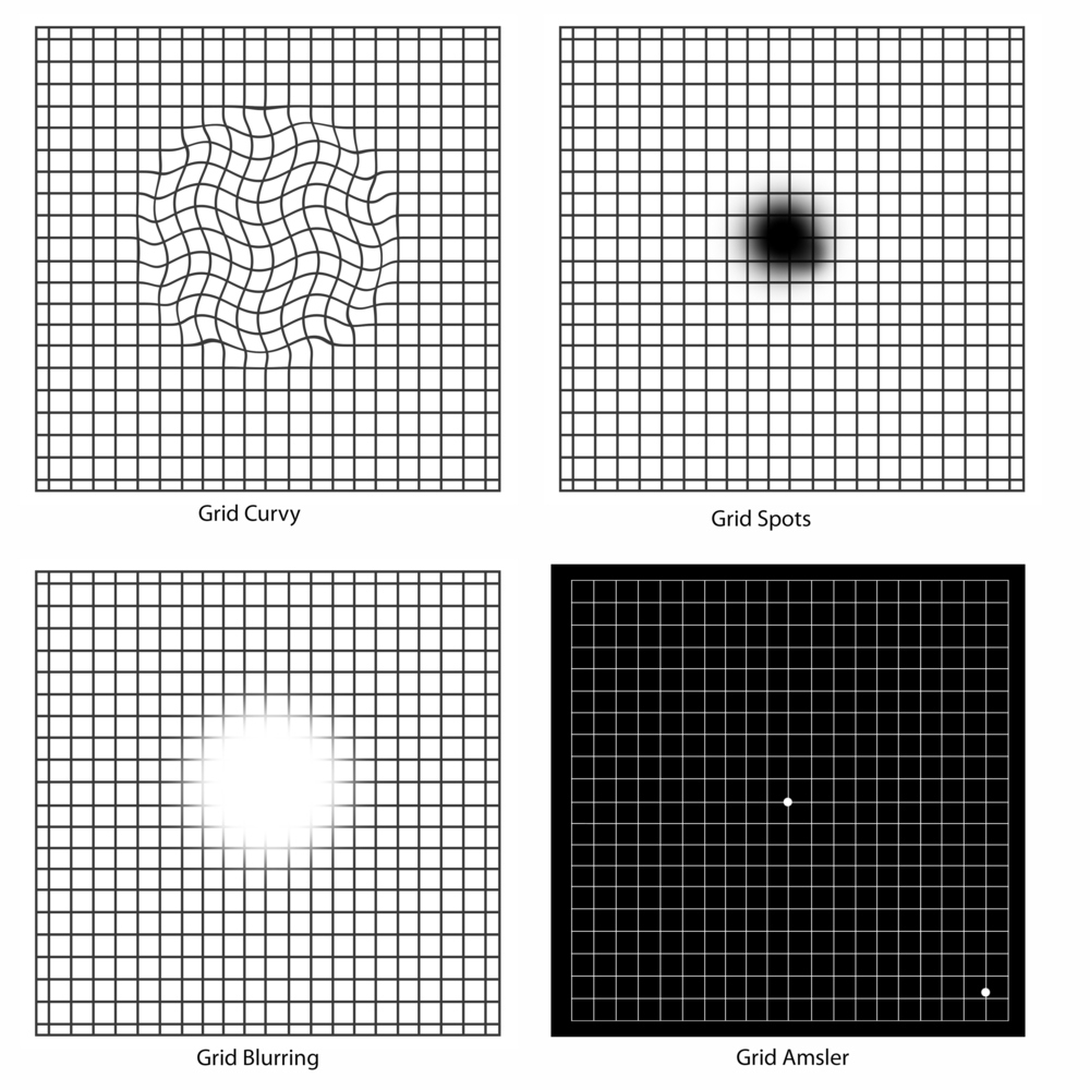 Macular Degeneration Grid: Check Your Vision With An Amsler Grid intended for Macular Degeneration Chart Printable