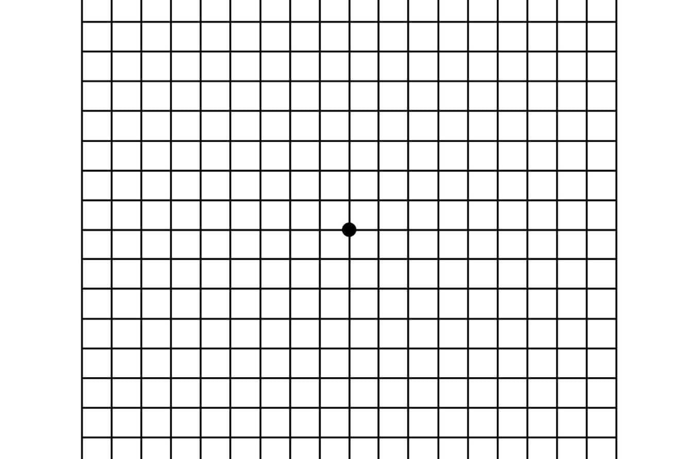 Macular Degeneration Test: How To Use The Amsler Grid inside Macular Degeneration Chart Printable