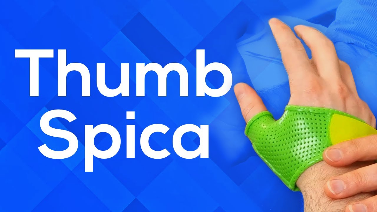 How To Make A Thumb Spica Splint pertaining to Hand Based Thumb Spica Splint Pattern Printable